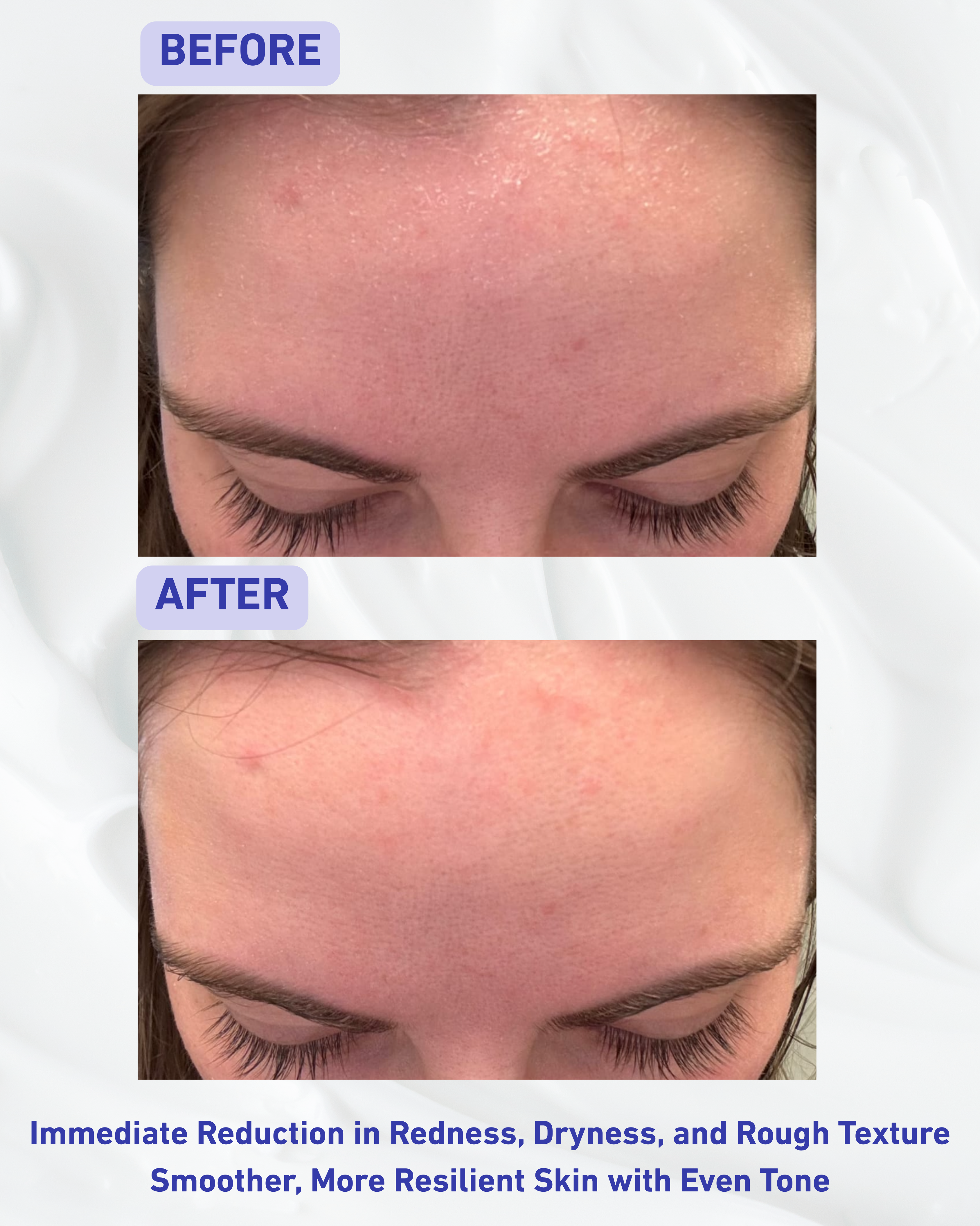 Skin Barrier Rescue & Repair Daily Moisturizer - Face & Body