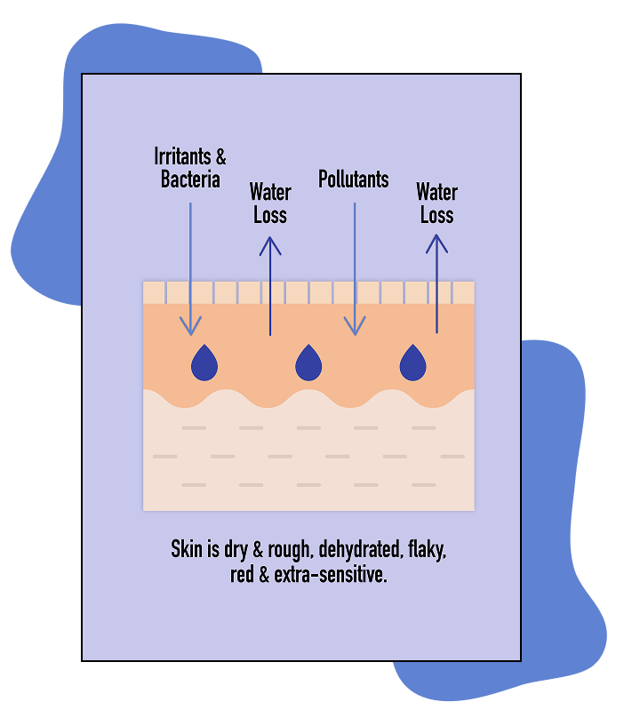 Graphic showing a damaged skin barrier letting in irritants, bacteria, and pollutants and letting water escape