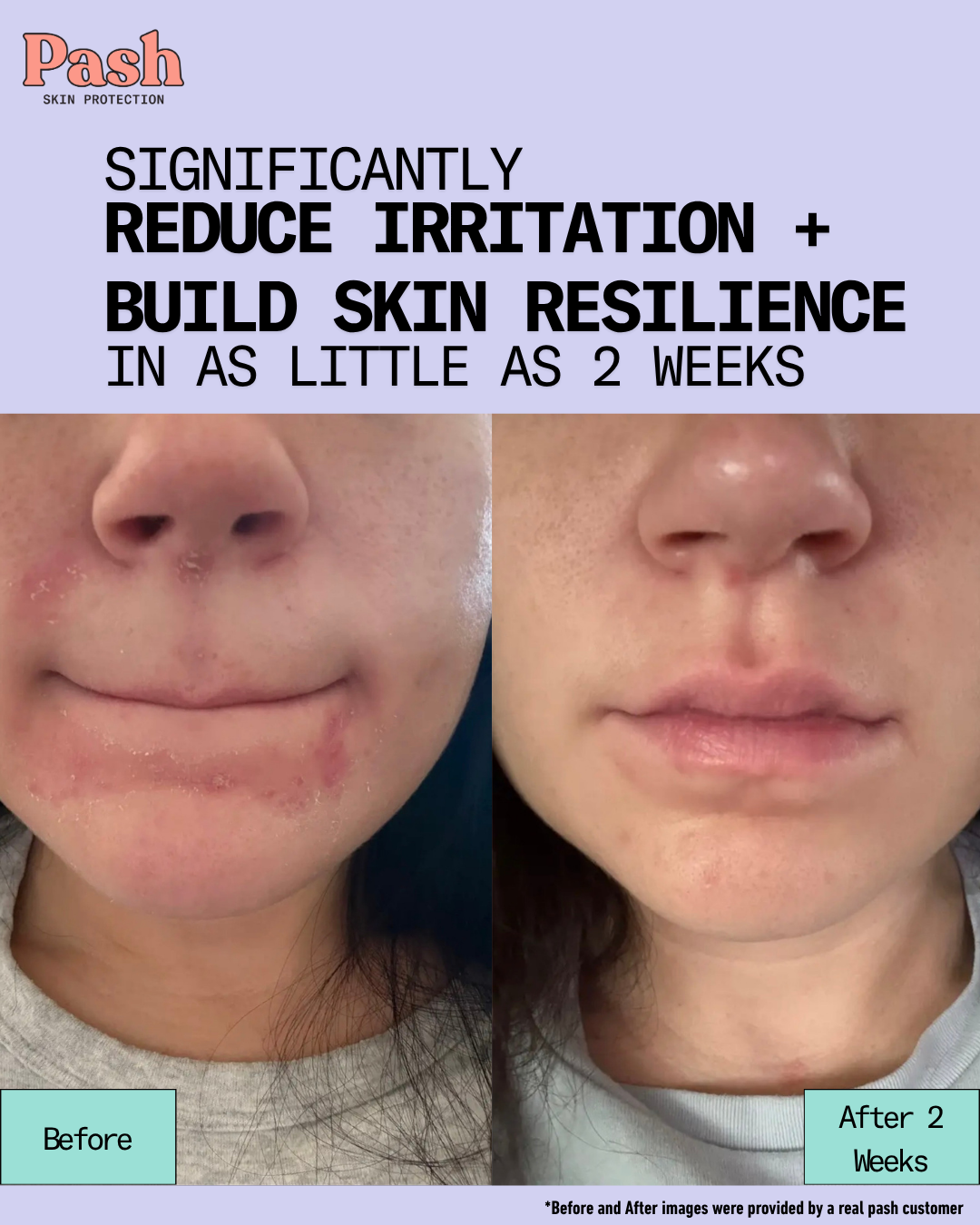 Skin Barrier Rescue & Repair Daily Moisturizer - Face & Body