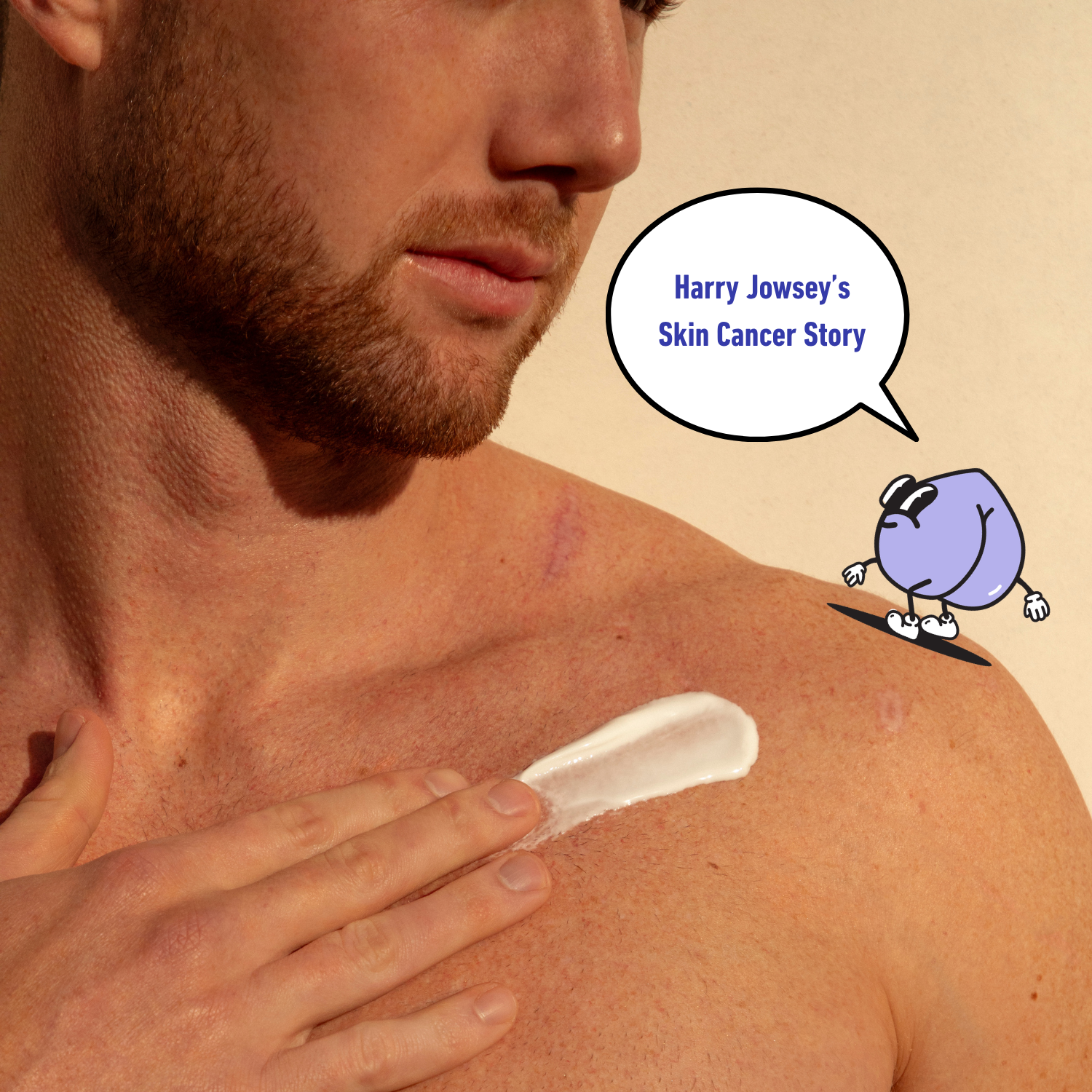 Harry Jowsey’s Skin Cancer Story