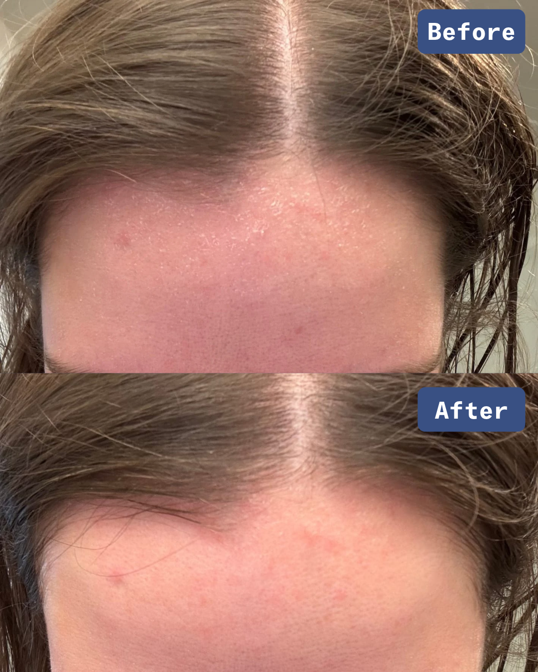 Skin Barrier Rescue & Repair Daily Moisturizer - Face & Body